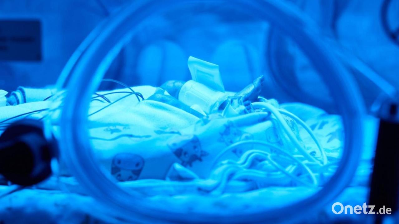 Hoffnung-f-r-Fr-hchen-KI-Modellprojekt-in-N-rnberg-startet