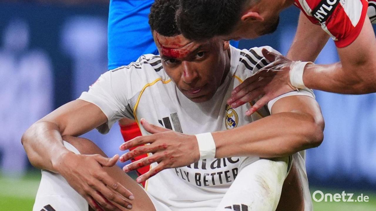 Vor Bayern-Rückspiel: Mbappé fehlt Madrid im Training