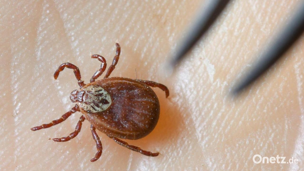 Zeckenstiche: Zahl von FSME-Erkrankungen leicht erhöht