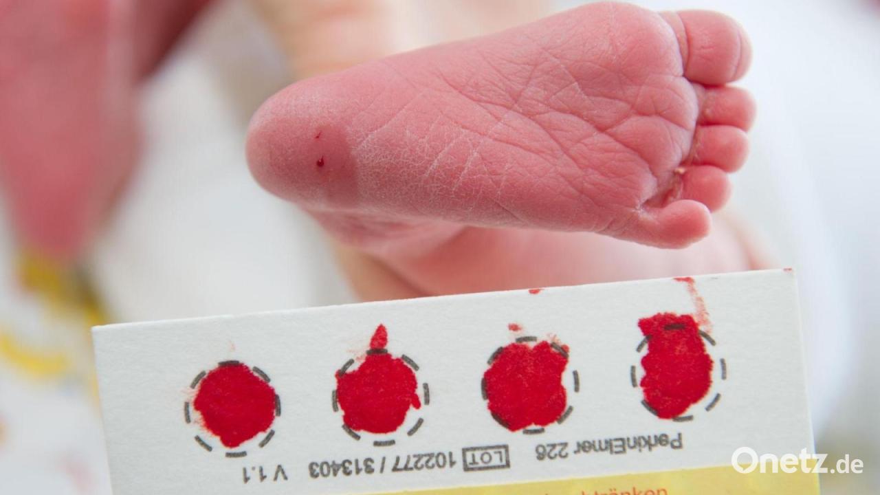 281 Mukoviszidose-Diagnosen bei Neugeborenen