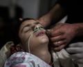 Ein verletztes Kind erhält Erste Hilfe in einem Krankenhaus in Al-Ghuta.	Bild: Anas Alkharboutli/dpa