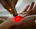 Symbolbild: Frank Rumpenhorst/dpa
Laser-Akupunktur bei einem Patienten. Der Glaubenskrieg zwischen "klassischen" Ärzten und Heilpraktikern geht in eine neue Runde. Letztere zeigen sich gesprächsbereit.