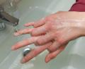 Bild: Patrick Pleul/dpa
Handhygiene­ gehört in Zeiten von Coronavirus und Influenza zu den wichtigsten Präventions­maßnahmen. Mindestens 20 bis 30 Sekunden die Hände mit Seife wachen. Dabei Handrücken, Daumen und Fingerzwischenräume nicht vergessen.