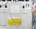 Bild: Cai Yang
Gespendetes Plasma eines geheilten Coronavirus-Patienten wird in einem Plasmabeutel aufgefangen. Foto: Cai Yang/XinHua/dpa/Symbolbild