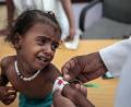 Bild:  Hani Mohammed
Ein Arzt misst den Armumfang eines unterernährten Mädchens im Aslam Health Center im Jemen. Die Vereinten Nationen bezeichnen den Krieg im Jemen als die größte humanitäre Katastrophe der Gegenwart.