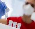 Bild: Rolf Vennenbernd/dpa
Drei Todesfälle im Zusammenhang mit Covid-19 meldet das Landesamt für Gesundheit am Freitag für die Region.
