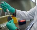 Symbolbild: Sebastian Gollnow/dpa
Ein Forscher zeigt im Landesgesundheitsamt Baden-Württemberg, wie ein PCR-Test für die Analyse auf Mutationen des Coronavirus vorbereitet wird.