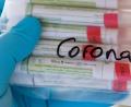 Symbolbild: Hendrik Schmidt/dpa
Proben für Corona-Tests werden für die weitere Untersuchung vorbereitet.