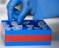 Symbolbild: Christophe Gateau/dpa
Eine Laborantin führt Untersuchungen zum Coronavirus durch. Foto: Christophe Gateau/dpa/Symbolbild