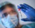 Symbolbild: Britta Pedersen/dpa
Im Landkreis Neustadt/WN galten laut 7-Tage-Statistik des Gesundheitsamts Neustadt-Weiden zwischen dem 17. und 23. August 28 von 38 Orten als coronafrei.