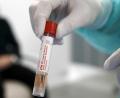 Bild: Salvatore Di Nolfi/KEYSTONE/dpa
Arzt, hat eine Probe einer Person, die im Verdacht steht, mit dem Coronavirus infiziert zu sein, in der Hand. In einem Amberger Pflegeheim haben sich mehrere Menschen infiziert.