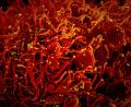 Bild: dpa/Europa Press/Niaid
Auf dieser vom US-Forschungszentrum "National Institute of Allergy and Infectious Diseases" (Niaid) zur Verfügung gestellten Aufnahme ist eine Zelle (rot) mit dem Coronavirus (SARS-Cov-2, gelb) infiziert.