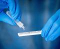 Archivbild: Kay Nietfeld/dpa
Corona-Schnelltests zeigten zuletzt in der Region Amberg-Sulzbach immer mehr Covid-19-Infektionen an. Das Infektionsgeschehen dürfte noch einige Wochen nicht abschwellen.