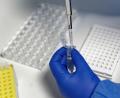 Symbolbild: Henning Kaiser/dpa
Eine Mitarbeiterin des Labors füllt mit einer Pipette, zur Vorbereitung von PCR-Tests, eine Testflüssigkeit ein.