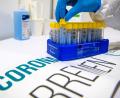 Symbolbild: Sina Schuldt/dpa
Proben für PCR-Tests auf das Coronavirus werden in einem Testzentrum für den Transport ins Labor verpackt. Im Landkreis Tirschenreuth gab es innerhalb einer Woche 758 positive Coronatests.