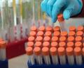 Bild: Hendrik Schmidt
Proben für Corona-Tests werden im Labor für die weitere Untersuchung vorbereitet.