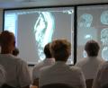 Archivbild: Klinikum/ Gräß
Alle zur Behandlung notwendigen Experten besprechen jeden einzelnen Patienten in der Tumorkonferenz am Klinikum St. Marien Amberg. Vor Corona gingen wesentlich mehr Menschen zur Krebsvorsorge. Fehlende Diagnostik führt mittlerweile zu höheren Tumorstadien bei der Erstdiagnostik, hieß es im Verwaltungsrat des Klinikums.