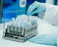 Bild: Uwe Anspach/dpa
Ein Mitarbeiter bereitet in einem Heidelberger Coronatest-Labor PCR-Teströhrchen vor.