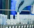 Symbolbild: Uwe Anspach/dpa
Ein Mitarbeiter hält in einem Coronatest-Labor PCR-Teströhrchen in den Händen.