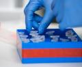 Bild: Christophe Gateau/dpa
Eine Laborantin sortiert im Institut für Virologie an der Charite Berlin Mitte, in dem Untersuchungen zum Coronavirus laufen, Proben. In Deutschland ist erstmals eine Infektion mit dem neuartigen Coronavirus bestätigt worden. Ein Mann aus Bayern habe sich infiziert, teilte ein Sprecher des Gesundheitsministeriums in München mit