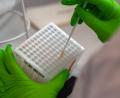 Archivbild: Robert Michael/dpa
Eine Mitarbeiterin im DKMS Life Science Lab,arbeitet an der Einsortierung der medizinischen Wattestäbchen mit Zellen der Wangenschleimhaut für den Typisierungsprozess der DNA.