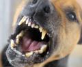 Symbolbild: Soeren Stache/dpa
Im Januar wurde ein Mann beim Holzmachen von einem frei laufenden Hund in Nabburg gebissen. Der Mann wurde im Gesicht und an einer Hand verletzt. Am vergangenen Mittwoch hetzte ein Hund ein Reg zu Tode.
