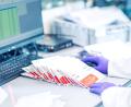 Symbolbild: Nick Heidmann
Das Symbolbild zeigt das Eintreffen und Einpflegen von Registrierungskits in die Datenbank bei der DKMS. Über ein privat zugeschicktes Set ist Matthias Bayer zum Stammzellenspender geworden.