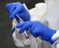Bild: exb/Hendrik Schmidt
Ein Test bringt Gewissheit, ob man sich mit dem Coronavirus angesteckt hat.