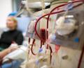Symbolbild: Arno Burgi/dpa
Dialyse ermöglicht Zehntausenden nierenkranken Patienten in Deutschland das Überleben. Auch im Landkreis Tirschenreuth gibt es Dutzende Betroffene.