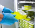 Bild: Guido Kirchner/dpa
Ehec steht für enterohämorrhagische Escherichia coli und bezeichnet bestimmte krankmachende Stämme dieses im Darm vorkommenden Bakteriums.