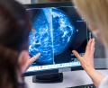 Bild: Hannibal Hanschke/dpa
Hochauflösende Mammographieaufnahmen können laut Susann Hueber von der FAU in Erlangen ein Segen, aber auch Grund für eine Überdiagnose sein.