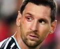 Bild: Ed Zurga/AP/dpa
Wieder gezeichnet: Superstar Lionel Messi.