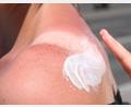 Bild: Stephanie Pilick/dpa/dpa-tmn
Sonnenbrand ist gefährlich - es drohen Langzeitfolgen.