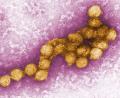 Bild: Cynthia Goldsmith/CENTERS FOR DISEASE CONTROL/EPA/dpa
Die Weltgesundheitsorganisation (WHO) hatte erst kürzlich wegen mehrerer Erkrankungen an West-Nil-Fieber in Südeuropa zu verstärkter Wachsamkeit aufgerufen.