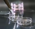 Symbolbild: Jens Kalaene/dpa
Bei einer In-vitro-Fertilisation werden Eizellen außerhalb des Körpers befruchtet. Der Soroptimist-International-Club Amberg-Sulzbach fordert nun, dass auch die Eizellspende in Deutschland legal wird.
