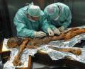 Bild: M.Samadelli/Southtyrolarchaeologymuseum\Eurac via Eurekalert/dpa
Ötzi wurde hundertfach untersucht