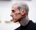 Bild: Jae C. Hong/Invision/AP/dpa
Travis Barker geht davon aus, dass er in ein paar Wochen wieder fit ist. (Archivbild)