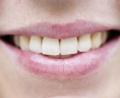 Symbolbild: Victoria Bonn-Meuser
Nach Angaben der Polizei ermittelt die Polizeiinspektion Amberg nach einer misslungenen Lippenbehandlung in Nürnberg wegen des Verdachts der Körperverletzung.