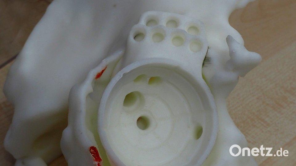 Ein Becken-3-D-Modell inklusive neuer Gelenkkugel aus Kunststoff. Wenn das Implantat passt, wird die Kugel in Titan gefertigt und eingebaut. Das Tirschenreuther Team um Professor Rudolf Ascherl ist bekannt dafür, auch vermeintlich hoffnungslose Fälle erfolgreich zu behandeln.