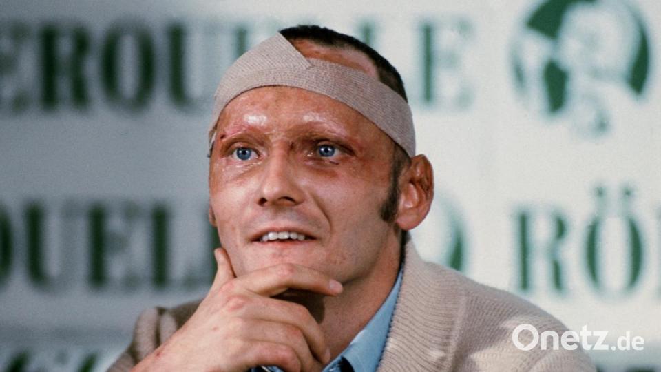 Der damalige österreichische Formel-1-Fahrer Niki Lauda gibt rund fünf Wochen nach seinem schweren Rennunfall auf dem Nürburgring mit vernarbtem Gesicht, Kopfbandage und Brandwunden eine Pressekonferenz. Bild: Hartmut Reeh/dpa