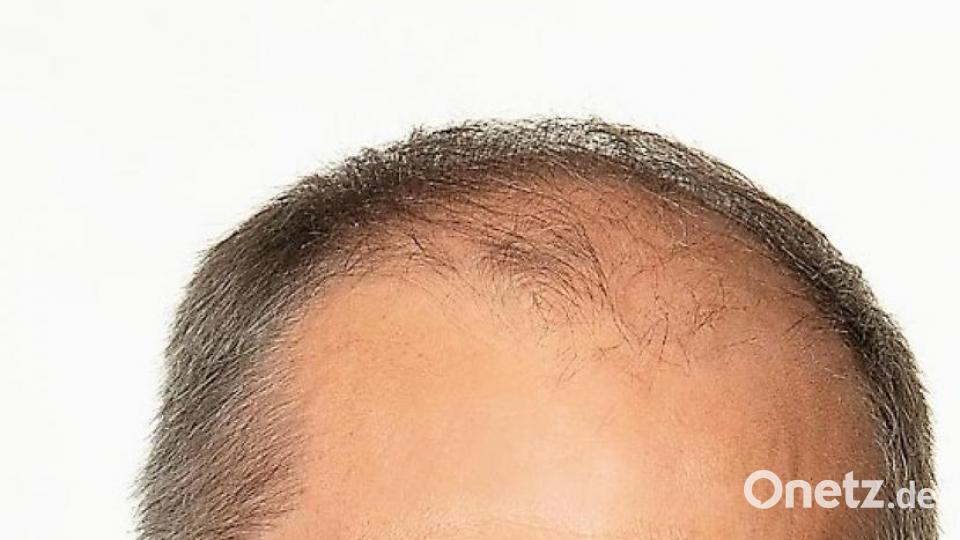 Bürgermeister Roman Schäffler: „Eigentlich ist es Ökologie pur, was hier gemacht wird“ Bild: stg