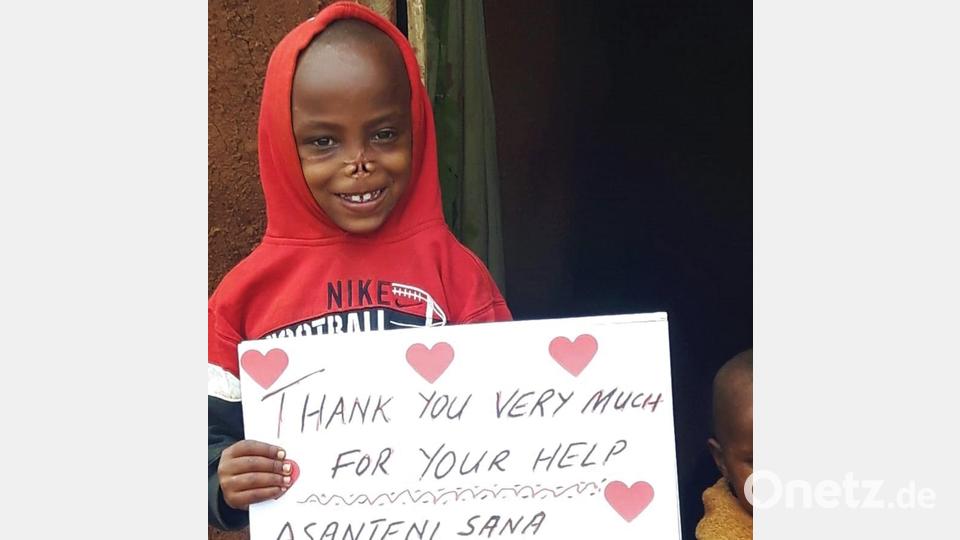 Daniel, der bei einem Hyänen-Angriff im Gesicht schwer verletzt worden war, freut sich auf die nun anstehende Operation und bedankte sich mit einem selbst gemalten Plakat für die Unterstützung. Bild: A. Schraml/exb