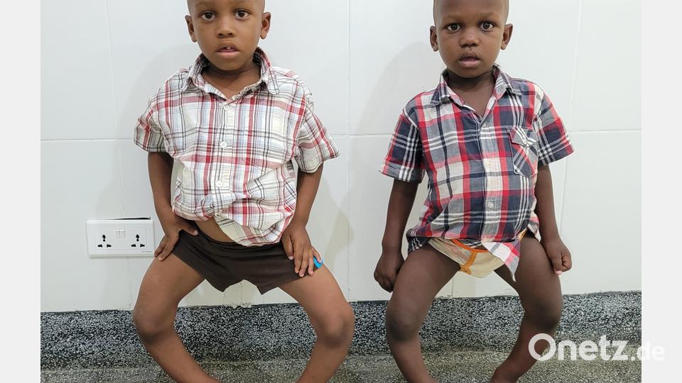 Die vierjährigen Zwillinge John und Johnathan litten an einer extremen O- und Innendrehfehlstellung beider Beine. Bild: Dr. Annemarie Schraml/exb