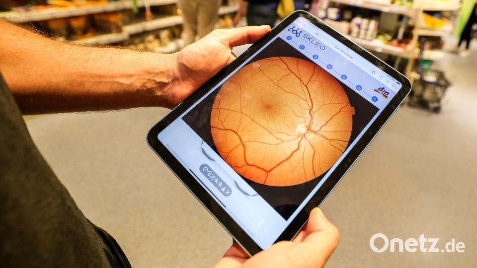 Ein Foto zeigt Details der Netzhaut. Bild: Christoph Reichwein/dpa