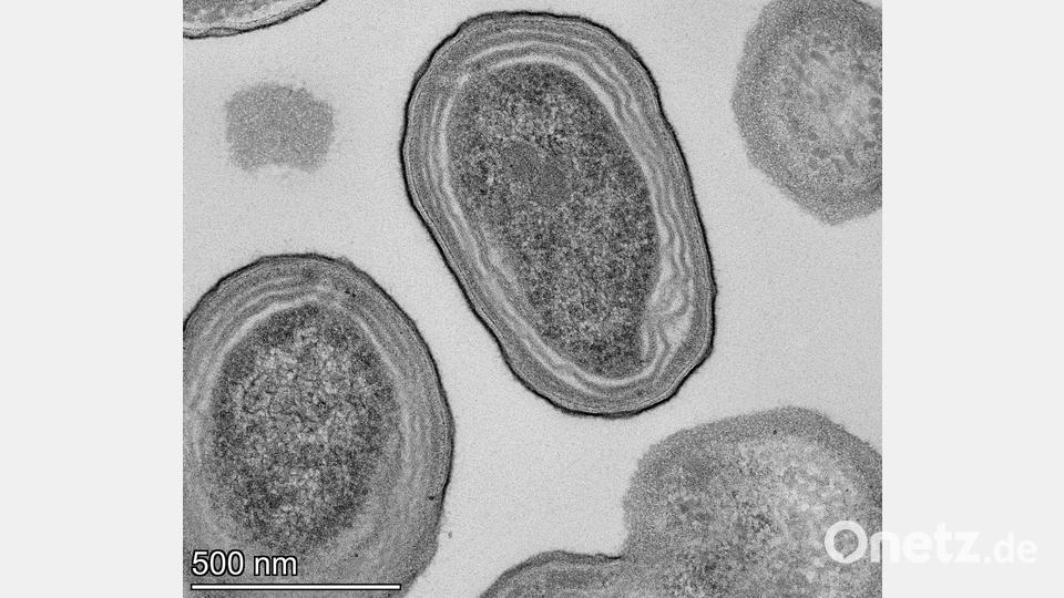 Elektronenmikroskopische Aufnahme von Prochlorococcus-Zellen. Bild: Natalie Kellogg/dpa