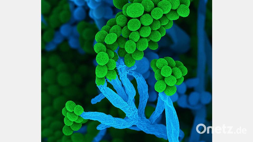 Penicillium bedeutet auf Lateinisch „kleiner Pinsel“, weil die Zellketten mit Sporen am Ende so ähnlich aussehen (Handout) Bild: Ulrich Kück/ Birgit Hoff/Vereinigung für Allgemeine und Angewandte Mikrobiologie/dpa