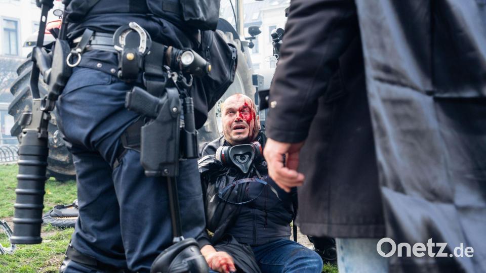 Ein Demonstrant sitzt verletzt auf einem Bordstein. Bild: Marius Burgelman/AP/dpa