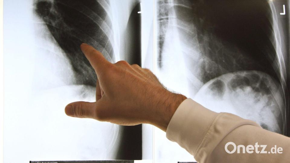 Patientenschützer sind über die geplanten Neuregelungen bei der Ärztewahl besorgt. (Archivbild) Bild: Arno Burgi/dpa-Zentralbild/dpa