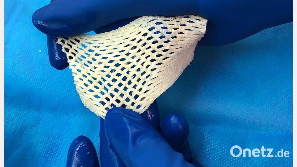 Wichtige Alternative für Hautttansplantationen: Fischhaut. Bild: Saziye Karaca/-/dpa