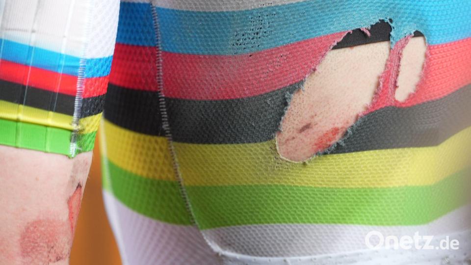 Die Folgen des Sturzes von Tadej Pogacar. Bild: Massimi Paolone/LaPresse via AP/dpa